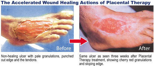 hp230